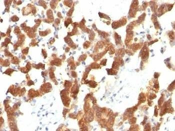 Anti-Cytokeratin 18 Antibody