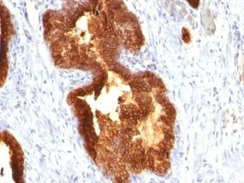 Anti-Cytokeratin 18 Antibody