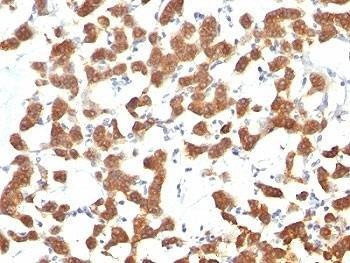 Anti-Keratin 18 Antibody