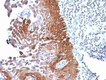 Anti-Cytokeratin 18 Antibody Cocktail