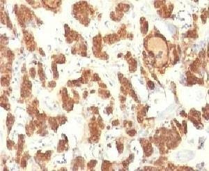 Anti-Cytokeratin 18 Antibody Cocktail