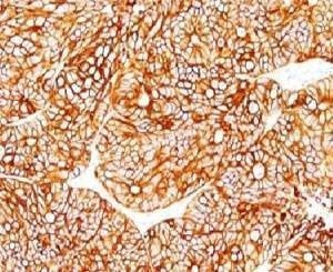 Anti-Cytokeratin 18 Antibody Cocktail, Sodium Azide Free