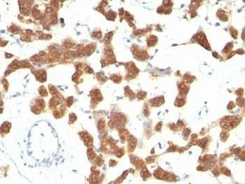 Anti-CK18 Antibody