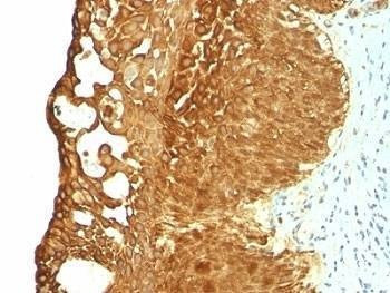 Anti-Cytokeratin 19 Antibody