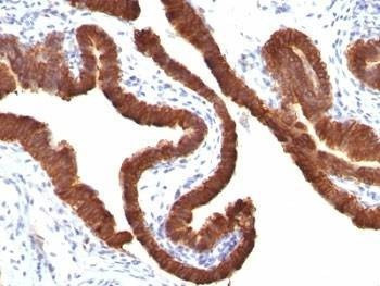 Anti-Cytokeratin 19 Antibody