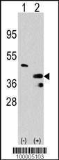Anti-PRMT1 (C-term) Antibody