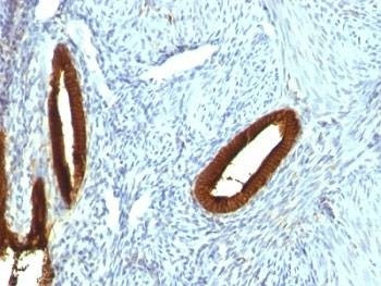 Anti-CK19 Antibody, Sodium Azide Free