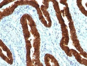 Anti-CK19 Antibody, Sodium Azide Free