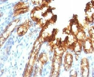 Anti-CK19 Antibody, Sodium Azide Free