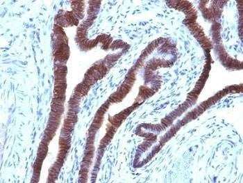Anti-EpCAM Antibody, Sodium Azide Free