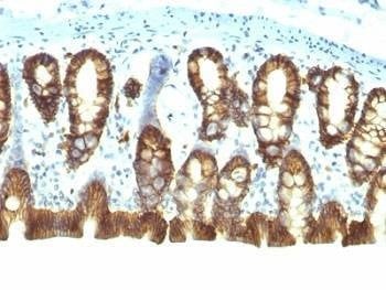 Anti-EpCAM Antibody, Sodium Azide Free