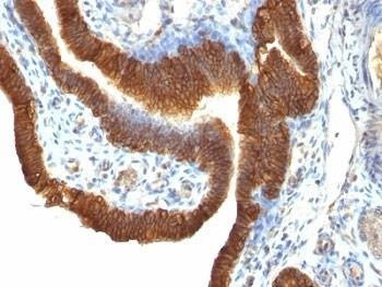 Anti-EpCAM Antibody, Sodium Azide Free