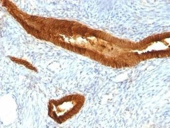 Anti-EpCAM Antibody, Sodium Azide Free