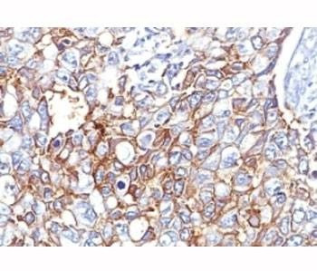 Anti-EpCAM Antibody, Sodium Azide Free