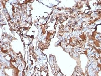 Anti-CD146 Antibody, Sodium Azide Free