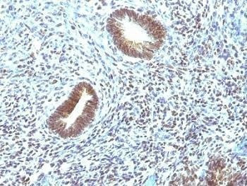 Anti-MAP3K1 Antibody