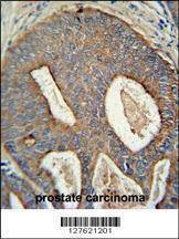 Anti-POTEB (C-term) Antibody