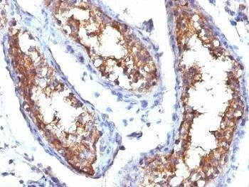 Anti-CD99 Antibody