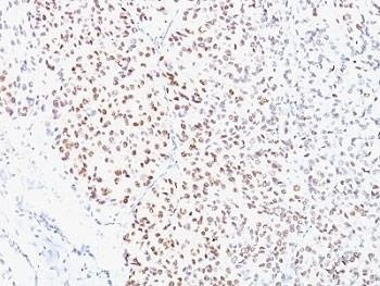 Anti-MITF Antibody, Sodium Azide Free