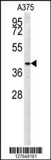 Anti-S35B2 (C-term) Antibody