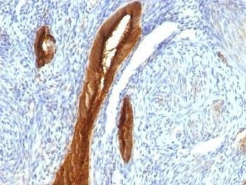 Anti-MUC1 Antibody