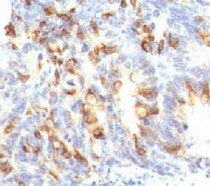 Anti-MUC2 Antibody