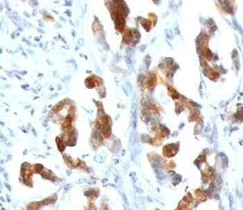 Anti-MUC5AC Antibody