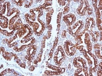 Anti-MUC5AC Antibody