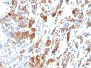 Anti-MUC5 Antibody