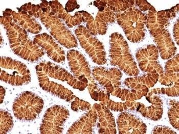 Anti-MUC5AC Antibody Cocktail