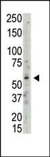 Anti-PRMT3 (C-term) Antibody