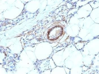 Anti-SMMHC Antibody