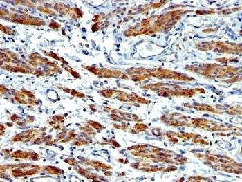 Anti-SMMHC Antibody Cocktail