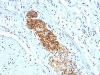 Anti-NCAM Antibody, Sodium Azide Free