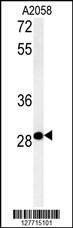 Anti-C11orf46 (C-term) Antibody