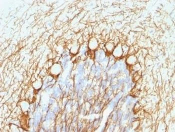 Anti-NF-H Antibody (phospho), Sodium Azide Free