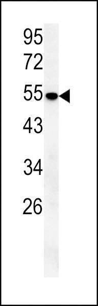 Anti-SLC43A2 (Center) Antibody