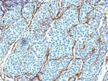 Anti-NGF Receptor Antibody, Sodium Azide Free