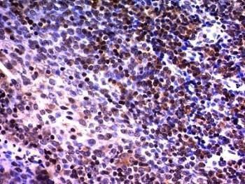 Anti-NuMA Antibody, Sodium Azide Free