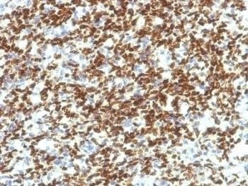 Anti-PAX7 Antibody, Sodium Azide Free
