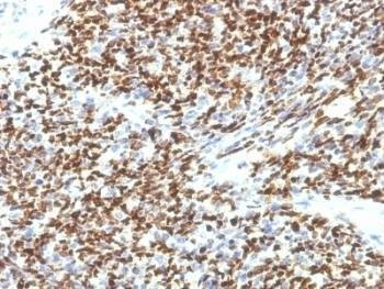 Anti-PAX-7 Antibody, Sodium Azide Free