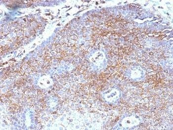 Anti-primates Beta-2 Microglobulin Antibody, Sodium Azide Free