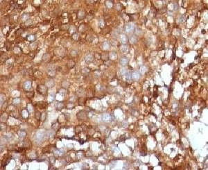 Anti-primates Beta-2 Microglobulin Antibody