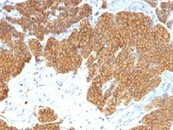 Anti-Parathyroid Hormone Antibody, Sodium Azide Free