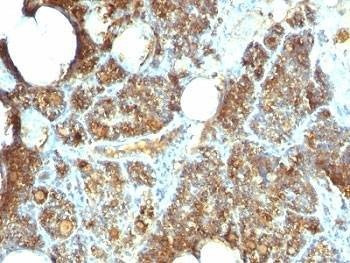 Anti-Parathyroid Hormone Antibody