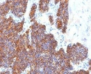 Anti-Parathyroid Hormone Antibody, Sodium Azide Free