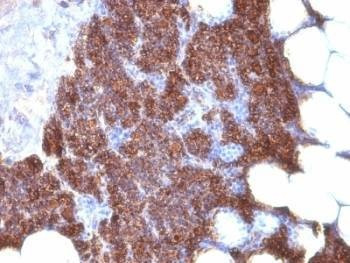 Anti-PTH Antibody Cocktail, Sodium Azide Free
