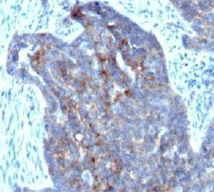 Anti-RBP1 Antibody, Sodium Azide Free