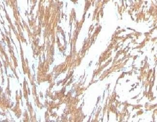 Anti-Alpha Smooth Muscle Actin Antibody, Sodium Azide Free