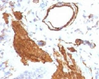 Anti-Alpha Smooth Muscle Actin Antibody, Sodium Azide Free